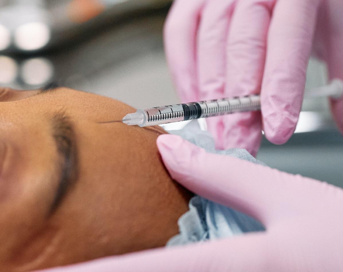 Mitos sobre Botox: o que você realmente precisa saber